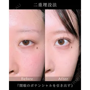 藤・ナチュレ美容クリニック 銀座院 小川 杏平医師の症例