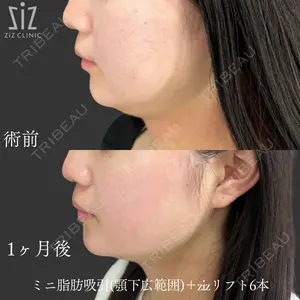 ziz CLINIC 村岡 史子医師の症例