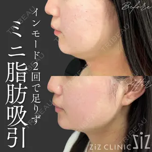 ziz CLINIC 村岡 史子医師の症例