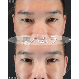 HAAB BEAUTY CLINIC 南青山本院（新院） 小平 佳典医師の症例