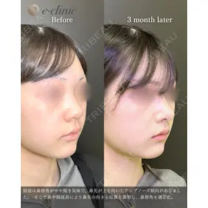 eクリニック 福岡院 伊藤 渉医師の症例