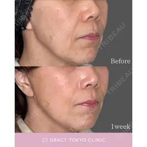 GRACY TOKYO CLINIC【グレイシートウキョウクリニック】 大西 真代医師の症例