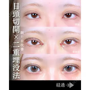 東京シンデレラ美容外科 池袋院 石井 達也医師の症例