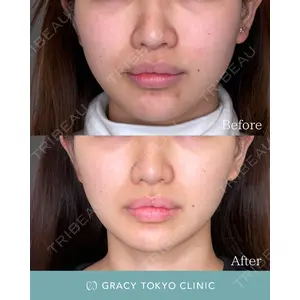 GRACY TOKYO CLINIC【グレイシートウキョウクリニック】 大西 真代医師の症例