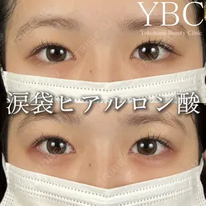 YBC横浜美容外科 立川院 大島 諒士医師の症例