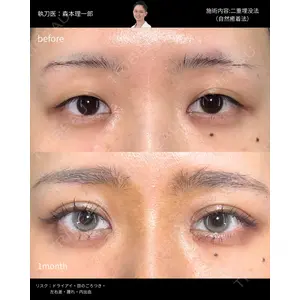 PRISM Beauty Clinic 町田院 森本 理一郎医師の症例