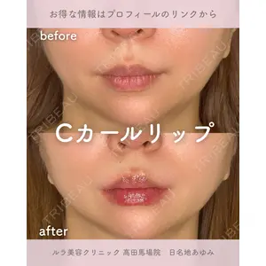 ルラ美容クリニック 高田馬場院 日名地 あゆみ医師の症例