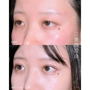 藤・ナチュレ美容クリニック 銀座院 小川 杏平医師の症例