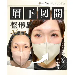 eクリニック 福岡院 伊藤 渉医師の症例