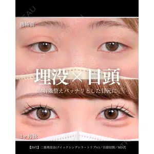東京シンデレラ美容外科 大宮院 竹田 昌平医師の症例