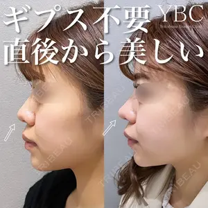 YBC横浜美容外科 池袋院 磯村 亮輔医師の症例