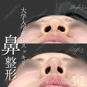 ziz CLINICの症例