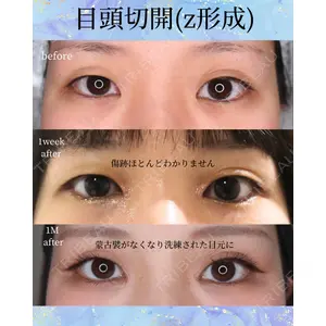 千葉美容外科アイビークリニックの症例