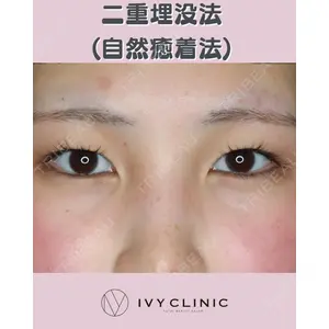 千葉美容外科アイビークリニックの症例