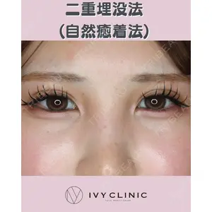 千葉美容外科アイビークリニックの症例