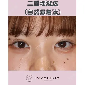 千葉美容外科アイビークリニックの症例