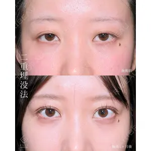 藤・ナチュレ美容クリニック 銀座院 小川 杏平医師の症例