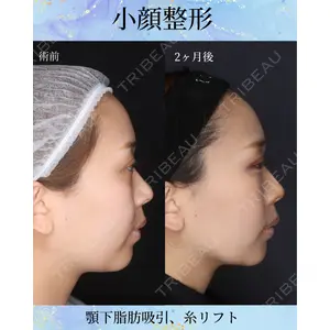 千葉美容外科アイビークリニックの症例