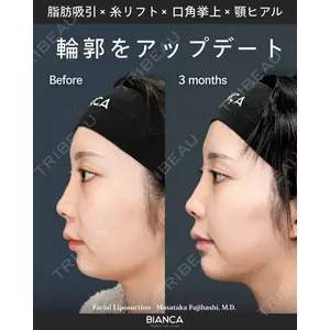 BIANCA銀座 藤橋 政尭医師の症例