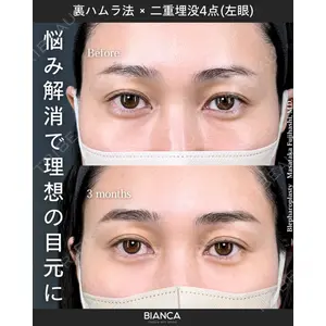 BIANCA銀座 藤橋 政尭医師の症例