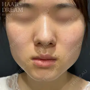 HAAB×DREAM BEAUTY CLINIC 東京本院 田中 優太医師の症例