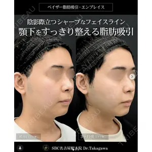 湘南美容クリニック 名古屋駅本院 高川 裕也医師の症例