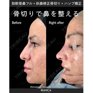 BIANCA銀座 藤橋 政尭医師の症例