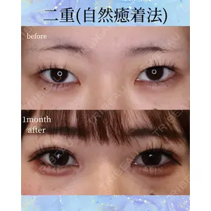 千葉美容外科アイビークリニックの症例