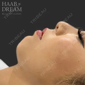 HAAB×DREAM BEAUTY CLINIC 東京本院 田中 優太医師の症例