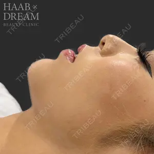 HAAB×DREAM BEAUTY CLINIC 東京本院 田中 優太医師の症例