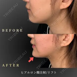 BiBiクリニック 山本 幸一郎医師の症例
