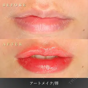 BiBiクリニック 山本 幸一郎医師の症例