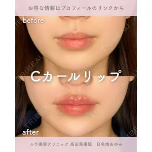 ルラ美容クリニック 高田馬場院 日名地 あゆみ医師の症例