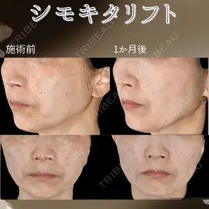 下北沢スキンクリニックの症例