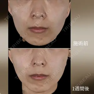 下北沢スキンクリニックの症例
