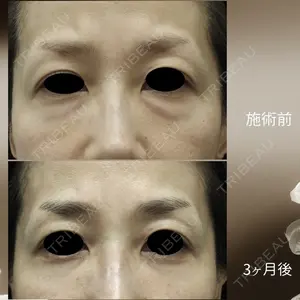下北沢スキンクリニックの症例