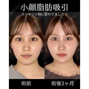 ルラ美容クリニック 仙台院 / ルラスキンクリニック 仙台院 橋本 英樹医師の症例