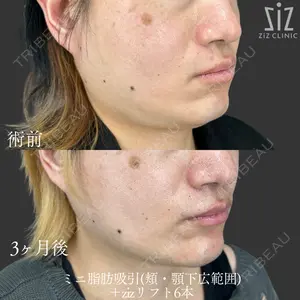 ziz CLINICの症例