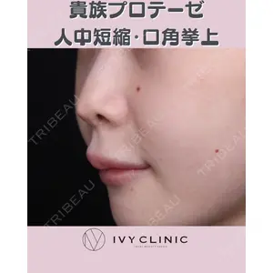 千葉美容外科アイビークリニックの症例