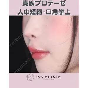 千葉美容外科アイビークリニックの症例