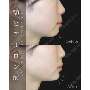 ルラ美容クリニック 大宮院 / ルラスキンクリニック 大宮院 右京 大季医師の症例