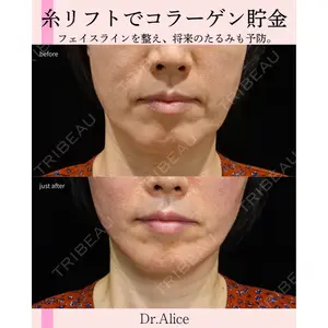 BIANCA銀座 幡手 亜梨子医師の症例