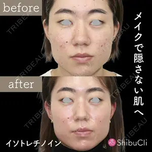 渋谷美容外科クリニック 新宿院の症例