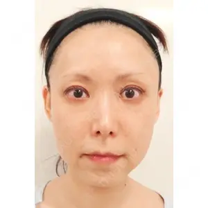 Kunoクリニック 梅田院 九野　広夫医師の症例