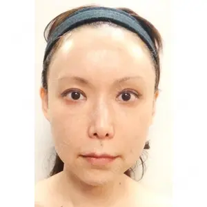 Kunoクリニック 梅田院 九野　広夫医師の症例