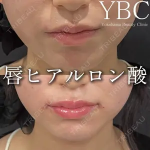 YBC横浜美容外科 立川院 大島 諒士医師の症例