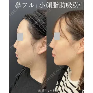 ルラ美容クリニック 広島院 角南 亮輔医師の症例