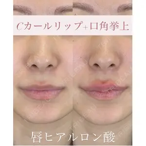 ルラ美容クリニック 広島院 角南 亮輔医師の症例