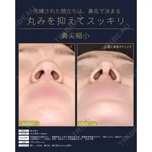 聖心美容クリニック 六本木院の症例