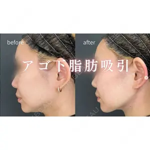 ルラ美容クリニック 神戸院の症例